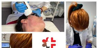 Laser & Mezoterapie cu acid hialuronic, secretul pielii revitalizate, la Clinica Alteo din Bistrița!