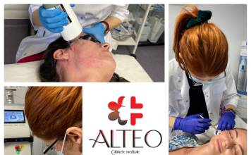 Laser & Mezoterapie cu acid hialuronic, secretul pielii revitalizate, la Clinica Alteo din Bistrița!
