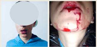 VIDEO/FOTO – Adolescent de 14 ani – bătut cu pumnii și picioarele, la doi pași de casă! Victima este internată în spital