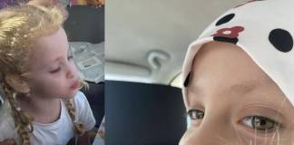 Mara are nevoie de noi, din nou! După un an de chin, o operație de mii de euro i-ar putea aduce zâmbetul pe față