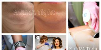 Rigoare medicală și tehnologie de top: Redefinește-ți silueta și scapă de celulită la Clinica ALTEO Bistrița!