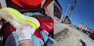 Un bistrițean și-a sclintit glezna într-o groapă lăsată de izbeliște pe Calea Moldovei